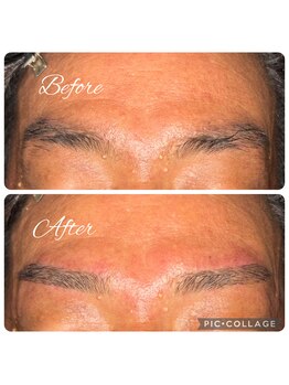 マイサロン(MY SALON)/年齢眉のお悩みに♪