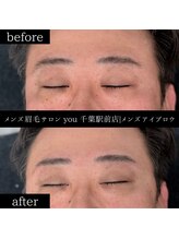 ユー 千葉駅前店(you)/ビフォ－アフター写真