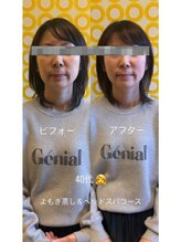 ドゥース 自由が丘(Douce)/施術ビフォーアフター