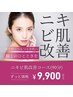 【人気ナンバー4!】つるつる美肌へ★ニキビ改善コース(90分)