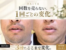 ダイヤ 名古屋中川区店(Daiya)