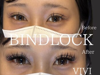 ビビ(VIVI)/【NO1】バインドロックつけ放題