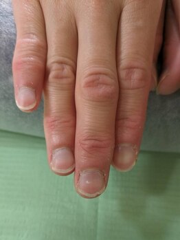 ロカスウィッチ(roca switch)の写真/《爪のお悩みお任せを★》手なら深爪、扇形、二枚爪。足なら巻き爪、タコ、魚の目、かかとのケアも◎