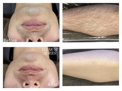 ベルフィオーレ(bel fiore)の写真