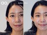 【トーンアップ肌♪全顔ワックス付】美眉スタイリングorまつ毛パーマ