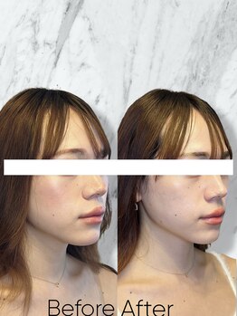 ルミライ(Lumirai)/モデルさん、芸能人御用達