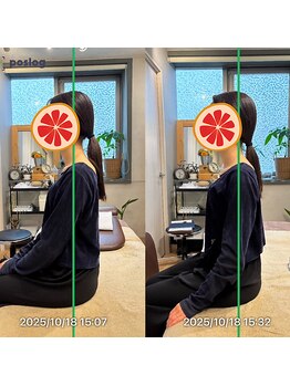 グレフル鍼灸接骨院 整体院 心斎橋/整体/肩こり/マッサージ/腰痛