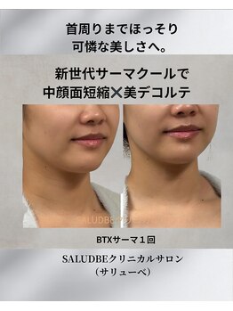 サリューベ(SALUDBE)/中顔面短縮&デコルテまで美しく