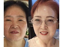 ICDスキンスタジオ 新宿三丁目(ICD-skin studio)/Before-After