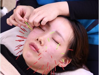 ながれかわ整骨院の写真/別府で美容鍼なら！乾燥・肌荒れを深部からケア。内側から輝く透明感と小顔を同時に叶える実力派施術★