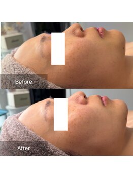 LiNOA./トーンアップ・リフトアップ