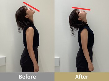 せなかのはね 難波心斎橋店/20代女性 ストレートネック