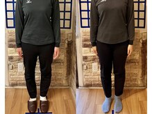 整体院リノベボディ(リノベBODY)/悩み：脚のフォルム［20代］