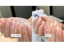 ツキカドットネイル(TSUKIKA.NAIL)の雰囲気（左 : 極度に薄く反り爪がお悩みだった10ヶ月前 / 右 : 現在）