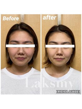 ラクシュミー ナチュラル(Laksmy NATURAL)/お客様ビフォーアフター