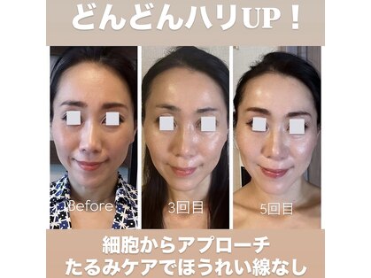 ラウレア ギンザ(Laule'a ginza)の写真