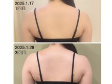 ほねつぎ一休さん 宇品店/背中・二の腕集中コース