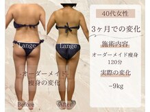 サロン ド ボーテ ラーンジュ 岐阜店(salon de beaut'e L'ange)/ハイパ-ナイフEX2ダイエット痩身