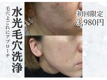 アルバ 広島店(ALBA)