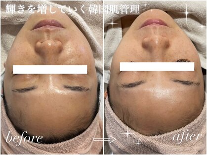 ジェイ(J)の写真