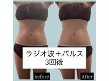 アリュールビューティー 下高井戸店(ALLURE BEAUTY)/モニター様紹介★