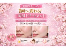 ムーンサン(Moon sun)