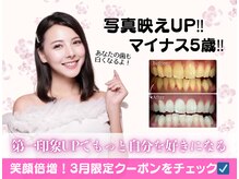 ホワイトニングショップ 多摩店