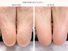 ディグニティ(Dignity)/足裏の角質が気になる方へ
