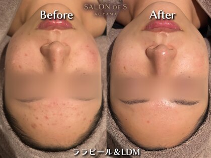 サロン ド エス アオヤマ(SALON DE S AOYAMA)の写真