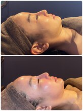 ベルフルール 西18丁目店/陶肌トリートメント＋コルギ