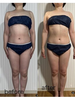 オリス(ORRIS)/ビフォーアフター