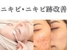 【でき物ケア】オーダーメイドピーリング60分 ￥25,000→￥15,000