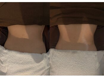 リル 恵比寿(llil.)/【BEFORE/AFTER】ウエスト