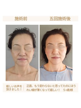 ヴェリタス(VERITAS)/原因は口元ではありませんでした