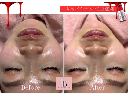 フォトビズの写真