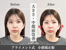 アライメント 自由が丘(Alignment)/小顔矯正☆