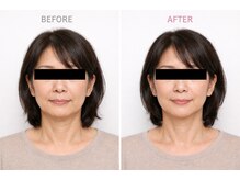 クラルスシンメトリーサロン 高槻店(Clarus Symmetry Salon)の雰囲気（ぼやけ輪郭がシャープに変化♪自然に引き上がる大人の小顔矯正♪）