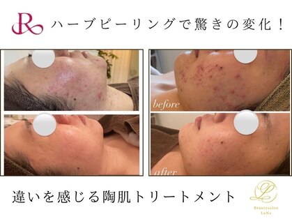 ラナ(LaNa)の写真