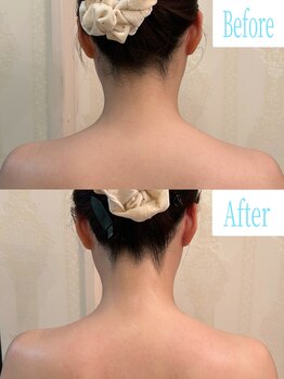 ヴェルセーヌ(VelleSaine)/後ろ姿に自信が持てる☆