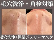 マヴィ 藤井寺店(MavY.)/毛穴黒ずみ角栓に