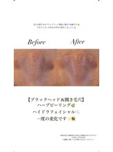 アイリス(AiRiS)/◎ブラックヘッド
