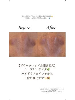 アイリス(AiRiS)/◎ブラックヘッド