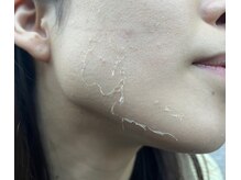 アイル 玉造店(iru)/ダウンタイム