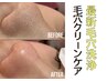 ★熊本希少★一度でスッキリ！初回限定★毛穴クリーンケア