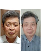 東洋経絡エステ アンド リラクゼーション/シミ改善コース