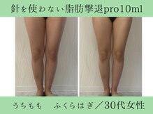 ソルニス(Solnis.)/痩身☆脂肪分解/ハイパーナイフ