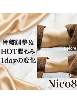 ニコエイト(Nico8)/◇骨盤調整&HOT腸もみ◇