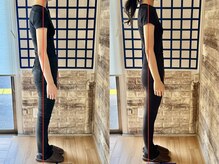 整体院リノベボディ(リノベBODY)/悩み：体型を薄くしたい［20代］