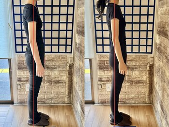 整体院リノベボディ(リノベBODY)/悩み：体型を薄くしたい［20代］