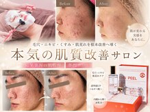 ホワイトアクア つくば店(WHITE AQUA)の雰囲気(韓国で話題沸騰中!最新★第4世代『ララピール』で憧れの水光肌)